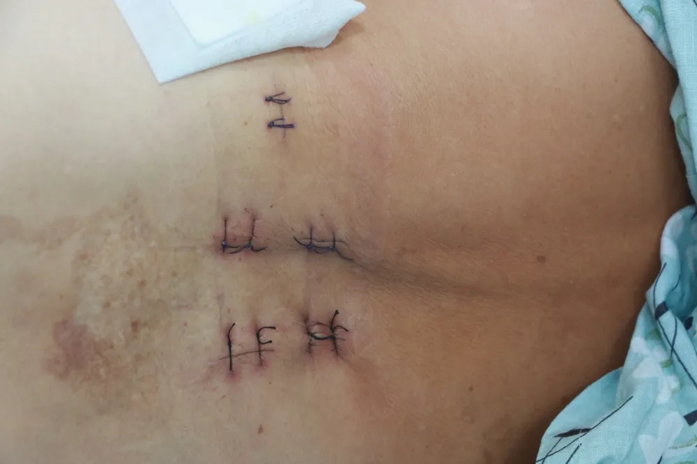 【6周年】专题Ⅲ之走进骨科——守护百姓骨骼健康(图8)